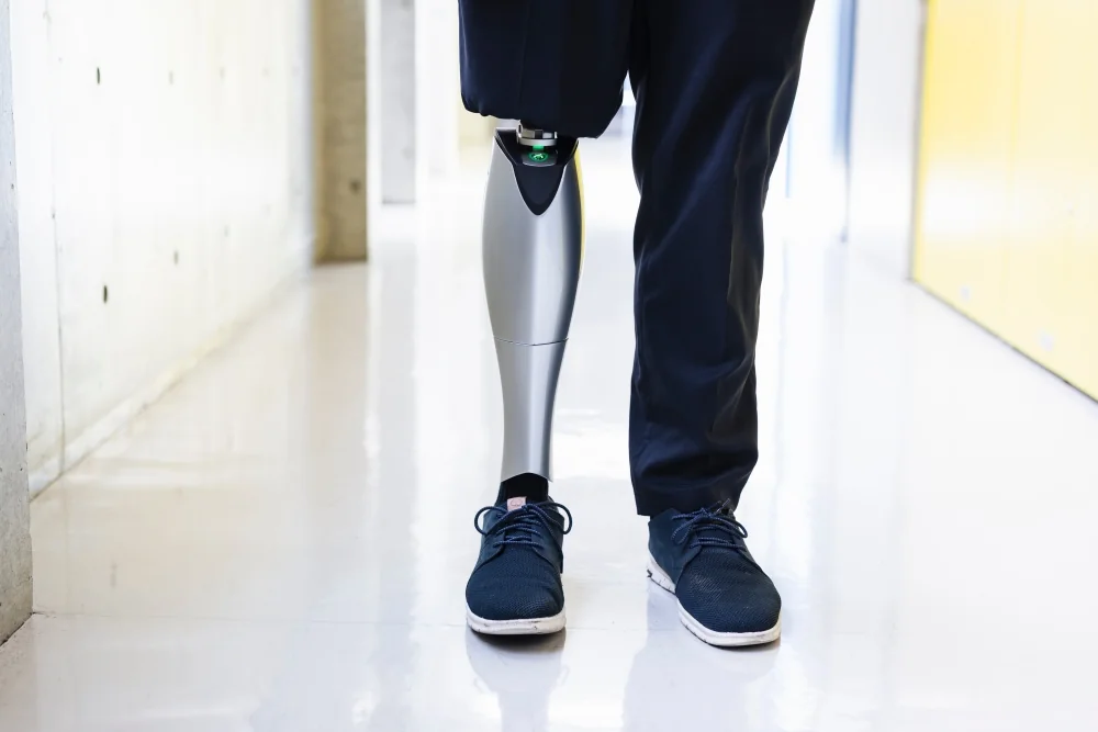 BionicMが開発中のパワード義足